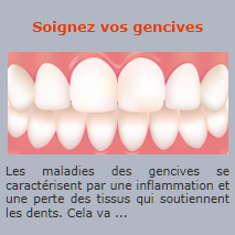 Soignez vos gencives