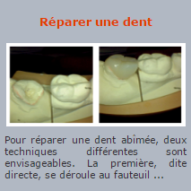 Réparer une dent